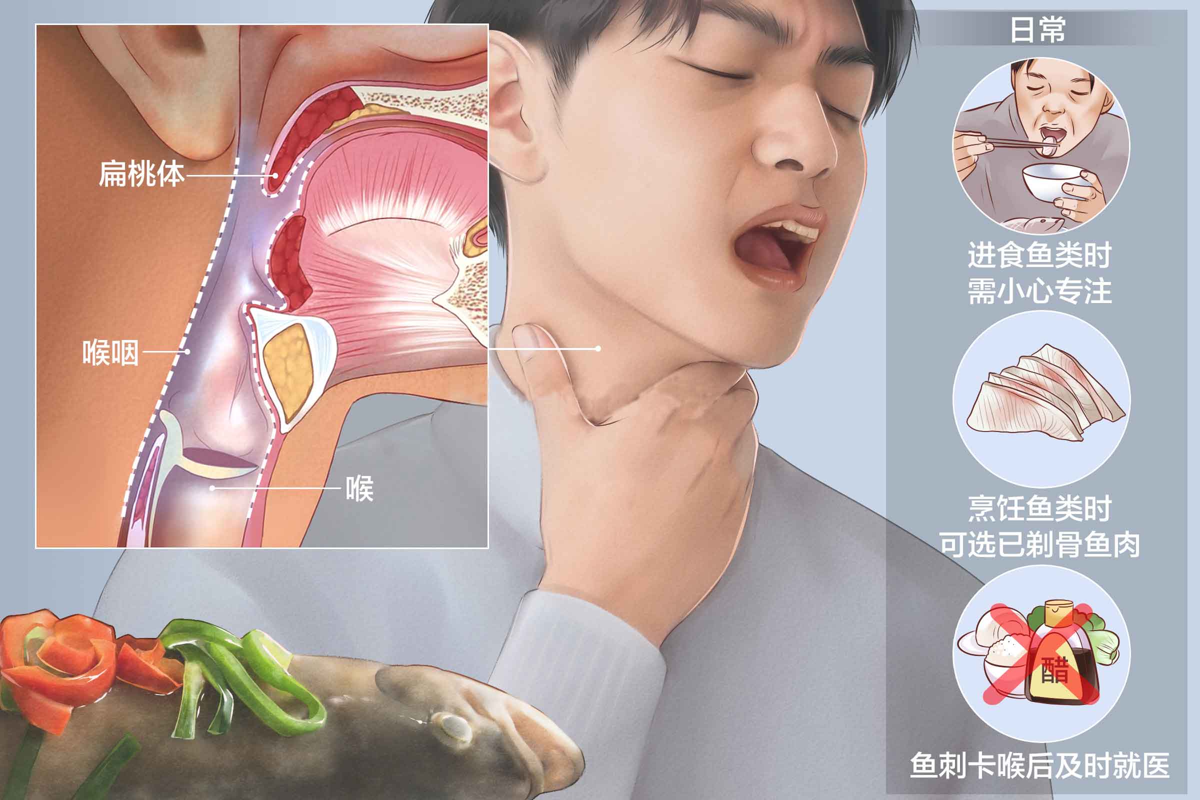 卡鱼刺太难受!吞咽疼痛难以入眠,仁品医院来解救你