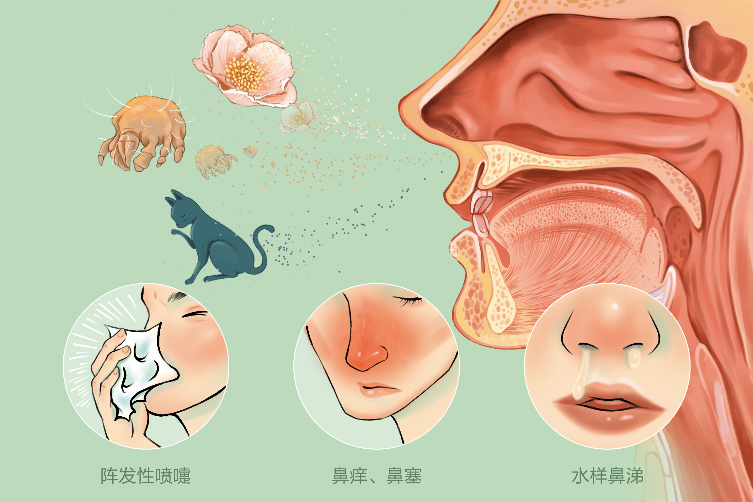 成都哪些人群易发过敏性鼻炎?仁品专家为您解析